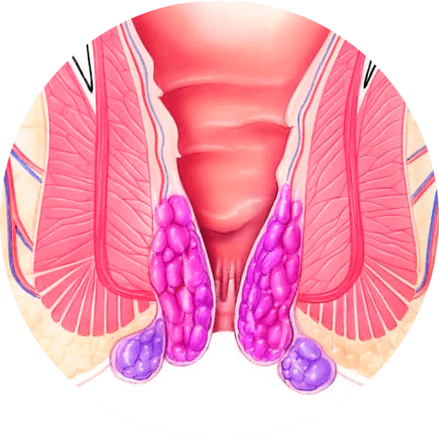 Gelarex atvieglo simptomus no pirmās lietošanas reizes